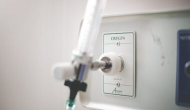 Mađarsko ministarstvo sumnja na prevaru pri kupovini respiratora tokom pandemije, izveštaj kod tužilaca | Srpska dijaspora