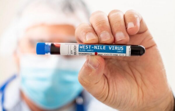 Virus Zapadnog Nila se širi Srbijom, većina obolelih sa teškim simptomima