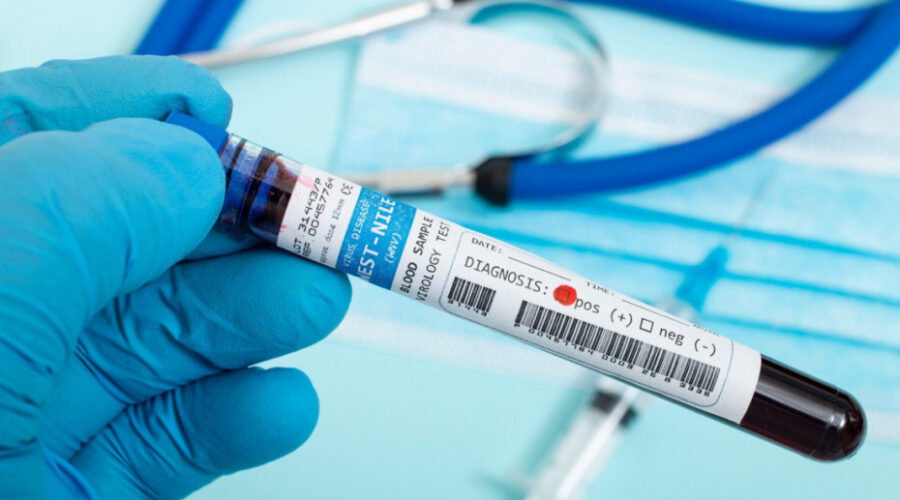 Virus Zapadnog Nila ponovo preti regionu: Kakva je trenutna situacija u Srbiji i kako se zaštititi