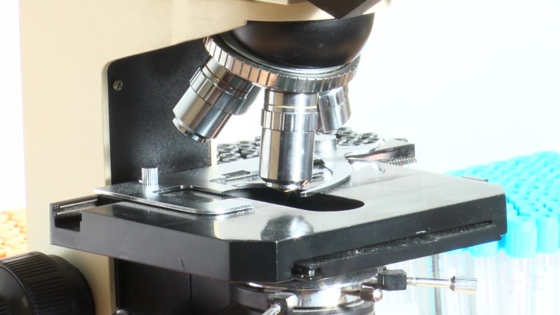 U Srbiji se godišnje dijagnostikuje oko 520 slučajeva multiplog mijeloma