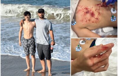 (Uznemirujuće) dečak (14) napadnut dok se kupao! Očajnički je pokušavao da se odbrani od pobesnelog dabra, životinja tresla glavom i kidisala bez prestanka!