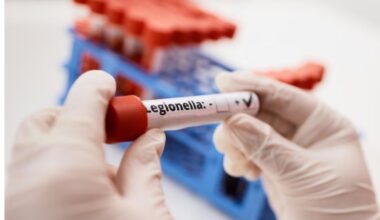 BATERIJA LEGONELA U KLINIČKOM CENTRU VOJVODINE: Tri pacijentkinje zaražene, zatim prebačene u Sremsku Kamenicu!