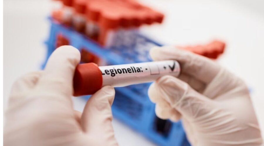 BATERIJA LEGONELA U KLINIČKOM CENTRU VOJVODINE: Tri pacijentkinje zaražene, zatim prebačene u Sremsku Kamenicu!