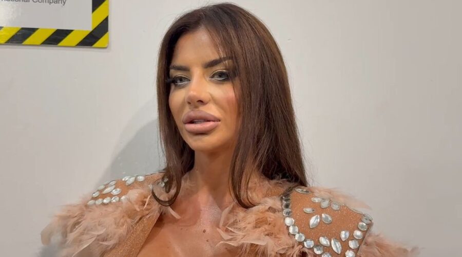 Bivša devojka Filipa Cara šokirala izgledom posle brojnih operacija, pa žestoko oplela po bivšem: “On pati…”