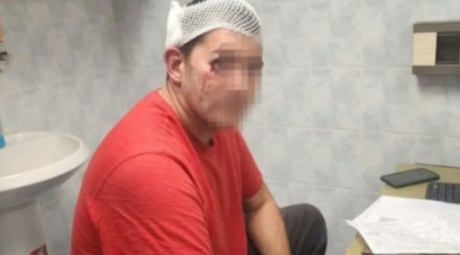 JOŠ JEDNO NASILJE NAPREDNJAKA TOKOM IZBORNE KAMPANJE: Posmatrač Agencije za sprečavanje korupcije pretučen kod štanda SNS-a!