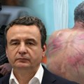"Kurtijevi: Policajci-mučitelji očigledno nagrađeni" Zverski pretukli Nenada Raškovića, sad su vraćeni na posao: Petković…