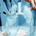 Srbija od 1. oktobra uvodi imunoterapiju za rak pluća, oko 1.000 pacijenata dobija šansu da drži bolest pod kontrolom