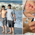 (Uznemirujuće) dečak (14) napadnut dok se kupao! Očajnički je pokušavao da se odbrani od pobesnelog dabra, životinja tresla…