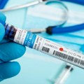 Virus Zapadnog Nila ponovo preti regionu: Kakva je trenutna situacija u Srbiji i kako se zaštititi
