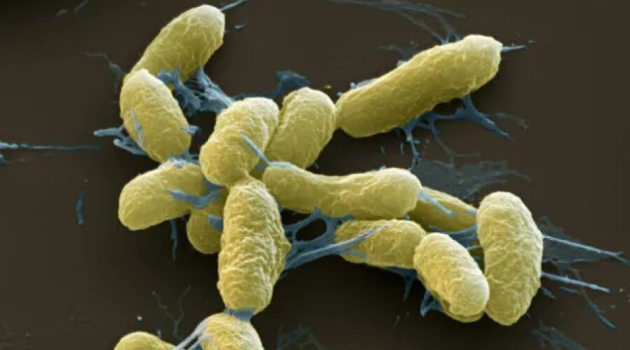 NOVI SMRTONOSNI VIRUS U RUSIJI? Istraživačica umrla od upale pluća nepoznatog porekla, hitno se oglasili iz Amerike