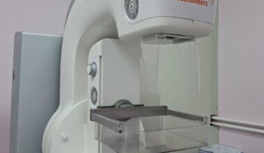 Preventivni ginekološki pregledi u Kragujevcu